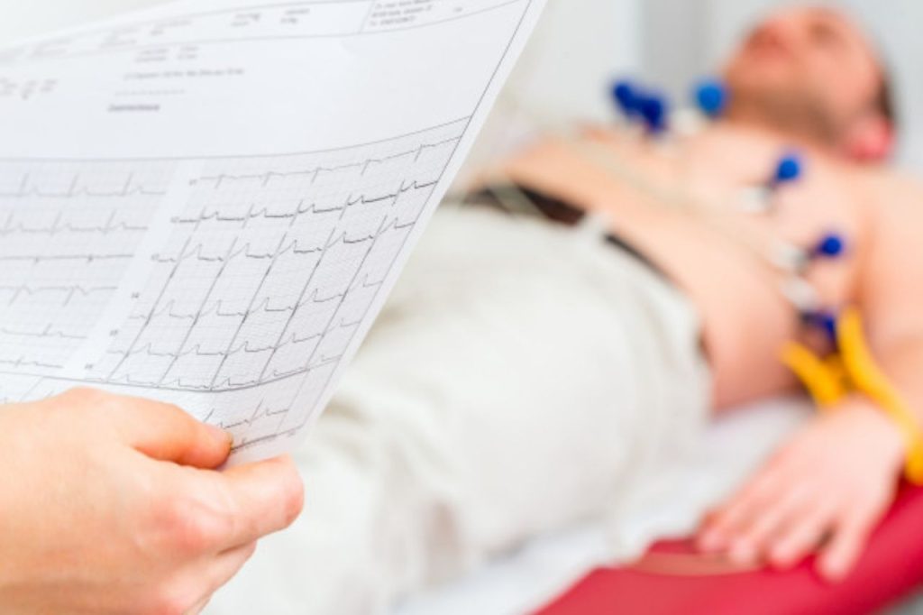 گرفتن نوار قلب در منزل کرج