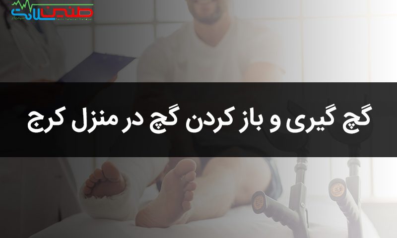 گچ گیری و باز کردن گچ در منزل کرج