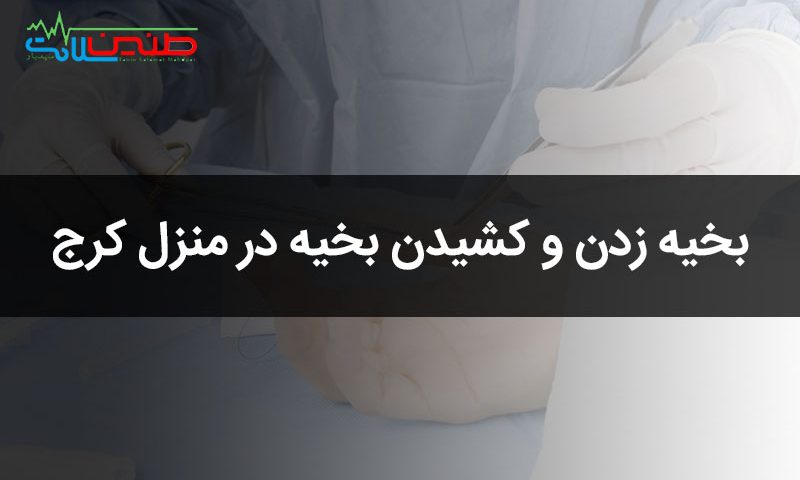 بخیه زدن و کشیدن بخیه در منزل کرج