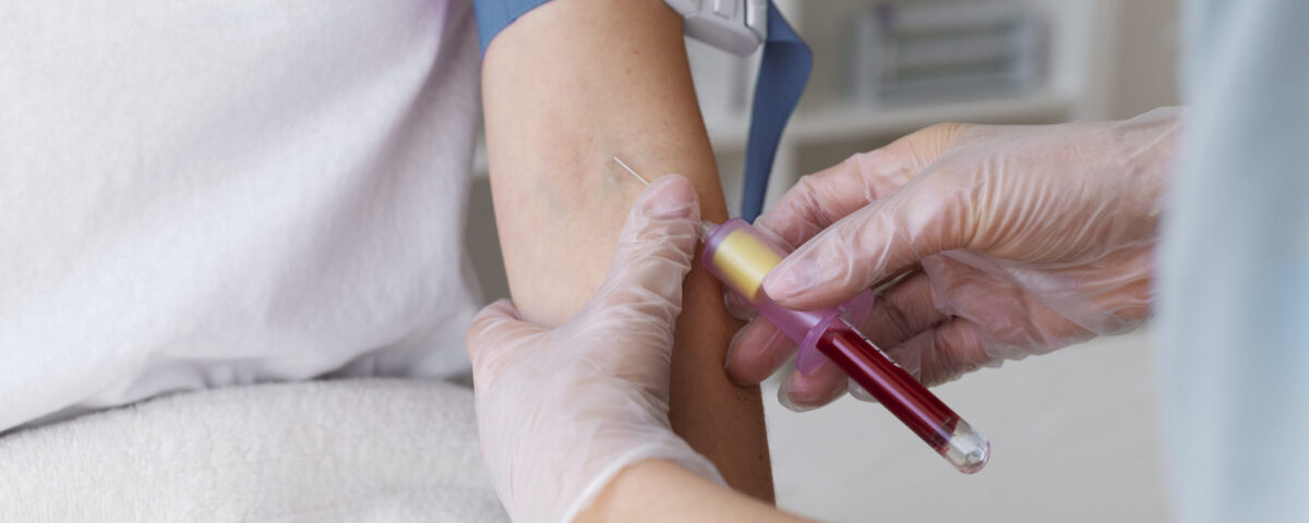 آزمایش خون در منزل حصارک