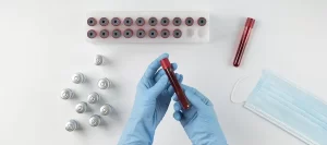 آزمایش خون در منزل حصارک