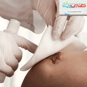 پانسمان در منزل کرج