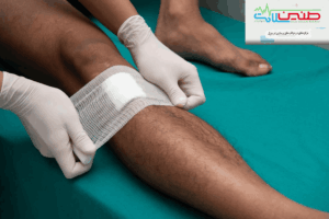 پانسمان در منزل کرج